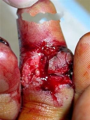 fingerme1-1-.jpg