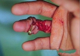FingerMe3.jpg