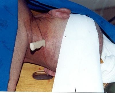 neck_stab07.jpg