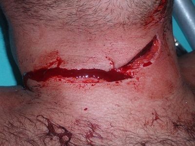 stab4.jpg