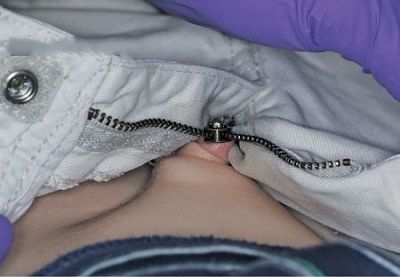 zipper.jpg