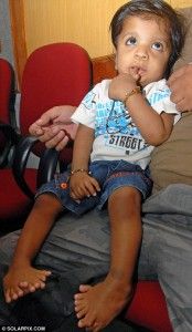 BOY-WITH-34-FINGERS-AND-TOES-SETS-WORLD-RECORD-174x300.jpg