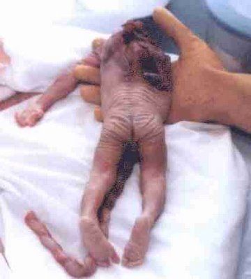 Baby10.jpg