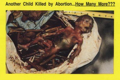 deadbaby1.jpg
