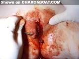 tn_charonboat_dot_com_female_circumcision5.jpg