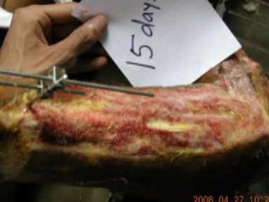crushed-hand-bindeswari-4.jpg