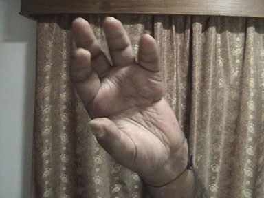crushed-hand-bindeswari-9.jpg