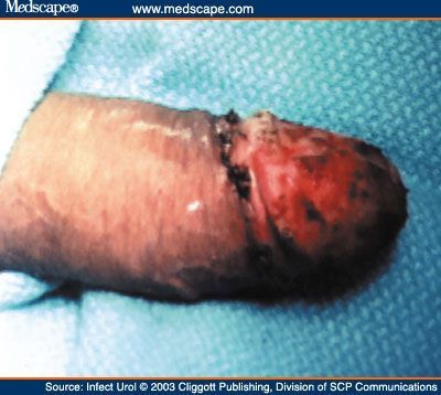 iiu460943_fig3.jpg
