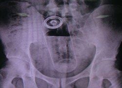 can u ass (2).jpg