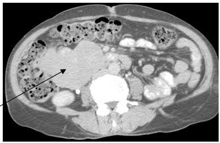 Name:  neuro-fig3.jpg
Views: 521
Size:  16.1 KB