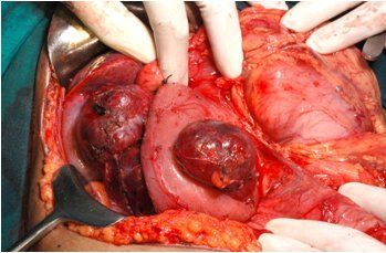 Name:  neuro-fig4.jpg
Views: 821
Size:  25.3 KB
