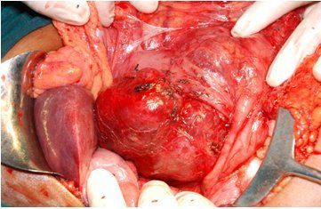 Name:  neuro-fig5.jpg
Views: 595
Size:  28.3 KB