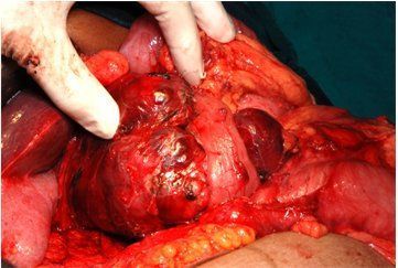 Name:  neuro-fig6.jpg
Views: 553
Size:  24.9 KB