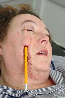 largeunusual-consequence-airbag-deployment.jpg
