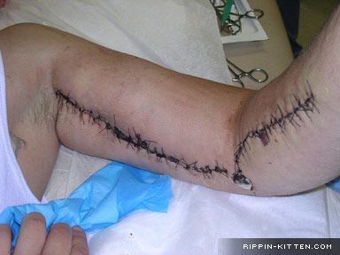ortho_stitches.jpg