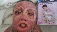 lovelydisgrace.com_whole-family-burned-2.jpg