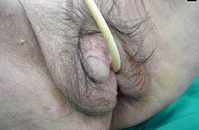 granny-hermp.jpg