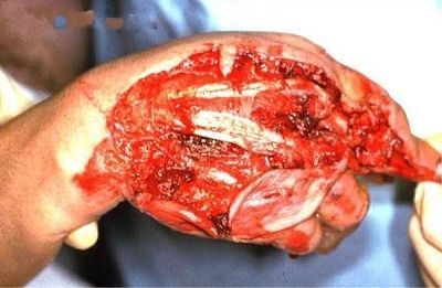 hand.jpg