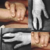 def hands.jpg