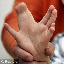 def hands 3.jpg