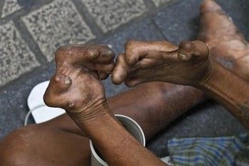 hand deform 4.jpg