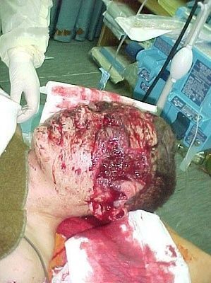 wounded-face.jpg