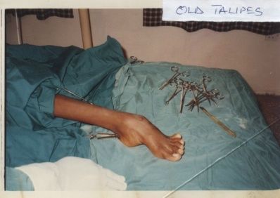 OLD_TALIPES.jpg