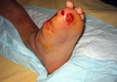 amptoe.jpg