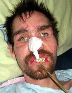 dustinbeforeandafter.jpg
