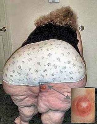 tub-lard-plus-boil.jpg