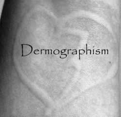 lens8056111_1293880047brokenheartdermographicur.jpg