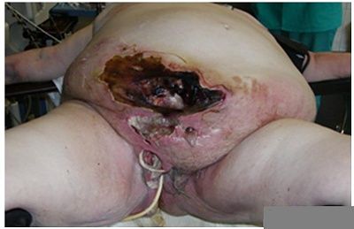 abdominal-fig1.jpg