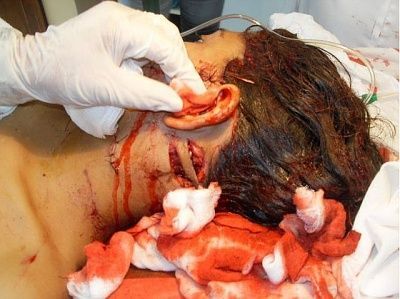 stabbed.jpg