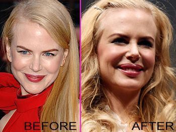 nicole-lips.jpg