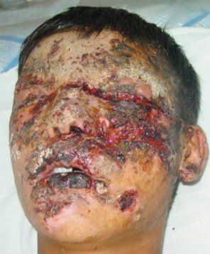 after%20surgery.jpg