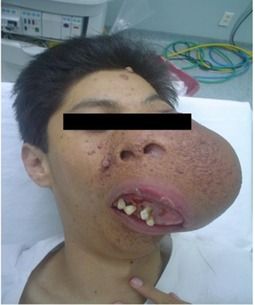 Name:  facial (1).jpg
Views: 2257
Size:  19.6 KB