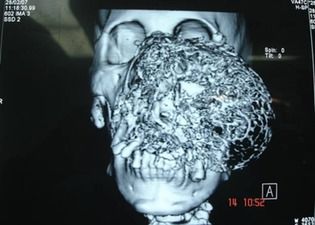 Name:  facial (2).jpg
Views: 1407
Size:  22.4 KB