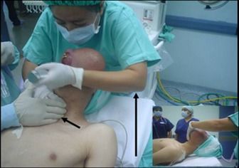Name:  facial 3.jpg
Views: 825
Size:  22.8 KB