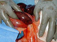 hernia01th.jpg