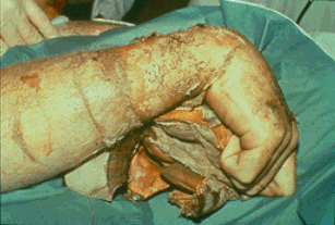 im-57.gif