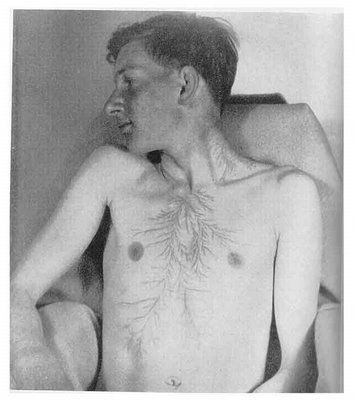 ElectricalInjury.jpg