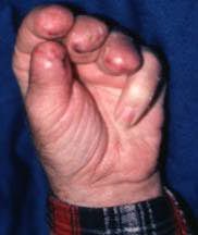 Name:  hand_snow_blower_187_2.jpeg
Views: 882
Size:  5.8 KB