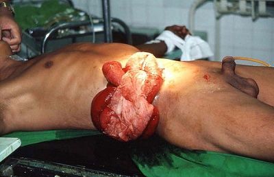 knife-wound.jpg