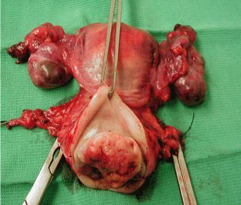 womb.JPG