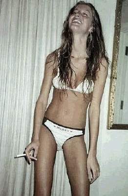 Anorexia__by_ravingxducky.jpg
