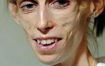 Kate-Chilver.jpg