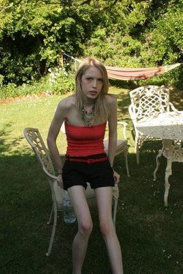 shockinganorexia3.jpg