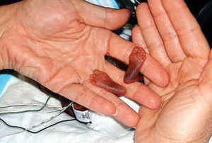 tiny%20feet,%20abortion,%20fetal%20pain,%20nebraska,%20national%20right%20to%20life,%20pain%20aw.jpg
