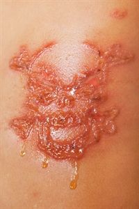 resized_henna1_300_300_FitSquare.jpg