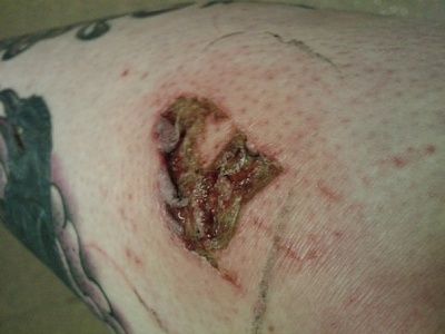 gash-1.jpg